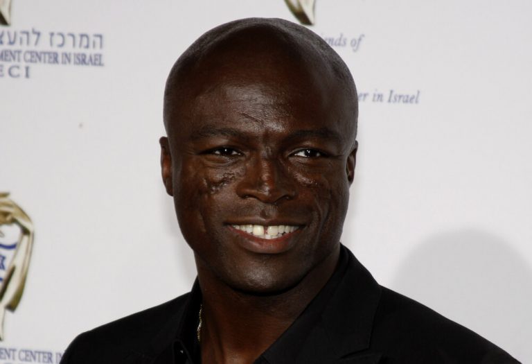 What Happened To Seal's Face?
